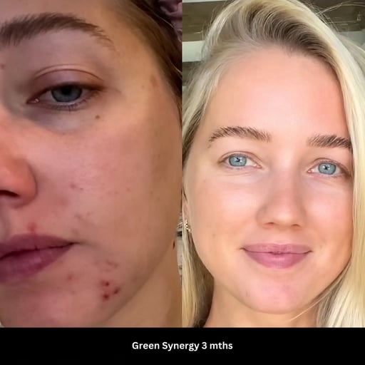 Green Synergy Results